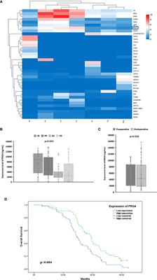 Proteoglycan-4 predicts good prognosis in patients with hepatocellular carcinoma receiving transcatheter arterial chemoembolization and inhibits cancer cell migration in vitro